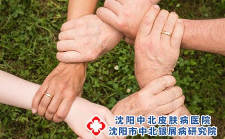 小儿荨麻疹应该如何治疗?
