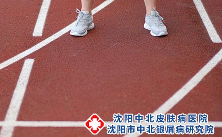 荨麻疹和麻疹是一样的吗?荨麻疹传染吗?