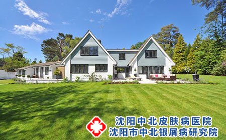 室内病毒感染会导致荨麻疹吗?日常注意?