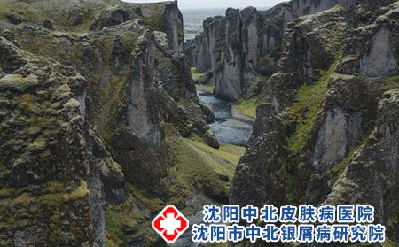 过敏性荨麻疹的症状有哪些?应该如何治疗?