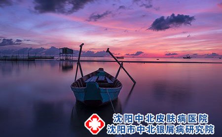 过敏性荨麻疹的症状有哪些?应该如何治疗?