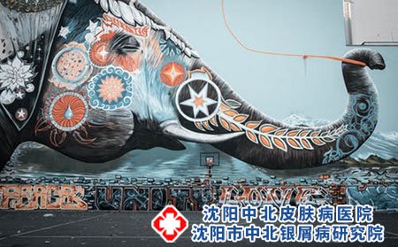 毛囊炎的发病原因与那些?有哪些危害?