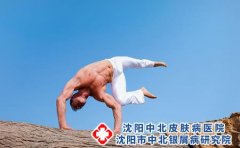 婴儿湿疹应该如何护理?应该注意些什么?