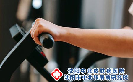什么是湿疹?湿疹的症状有哪些?