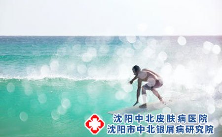 治疗皮炎要避开一些误区