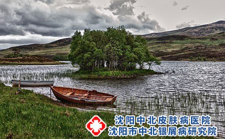 过敏性皮炎衣食住行都要注意些什么?