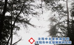 沈阳中北皮肤病医院为您介绍脚气很痒怎么办?