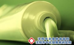 脚气的危害有哪些?如何预防脚气?