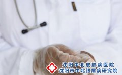 角化型脚气容易复发的原因有哪些?应该如何护理