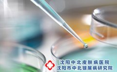 小儿荨麻疹有哪些常见的症状?
