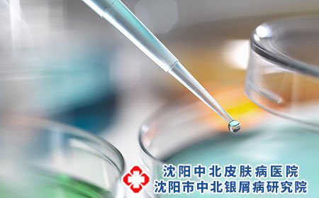 小儿荨麻疹有哪些常见的症状?