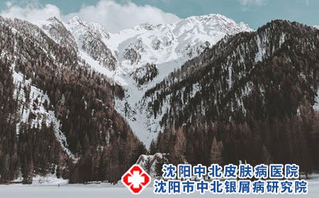 荨麻疹常见的过敏原有哪些?如何护理?