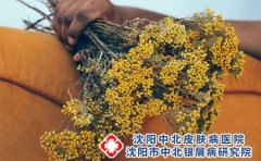 婴儿湿疹要多注重母乳喂养