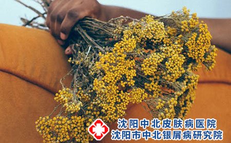婴儿湿疹要多注重母乳喂养