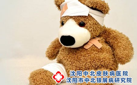 预防婴儿湿疹要防患于未然