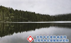 头部毛囊炎复发的原因有哪些?怎么护理?