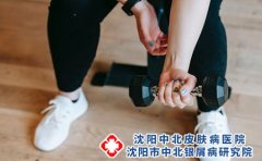 沈阳中北皮肤病医院为您介绍神经性皮炎