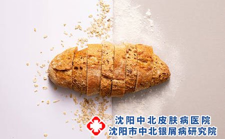 沈阳中北皮肤病医院为您介绍神经性皮炎
