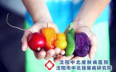 不注意个人卫生会引起脚气吗?
