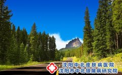 脚气的分类有哪些?治疗脚气要注意什么?