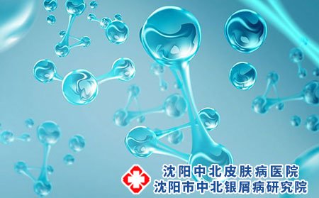 得了脚气日常应该如何护理?如何预防?