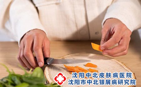 得了脚气日常应该如何护理?如何预防?