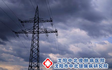原发性刺激物会导致接触性皮炎吗?