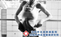 皮炎湿疹的危害有哪些?发病原因有哪些?