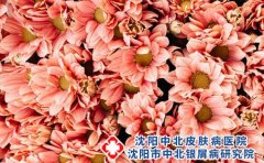 湿疹在日常生活中应该如何护理?