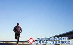 荨麻疹不同症状表现有哪些?饮食禁忌?
