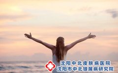 如何预防荨麻疹?治疗方法有哪些?