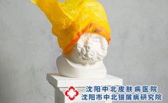 宝宝得了湿疹应该如何喂养?