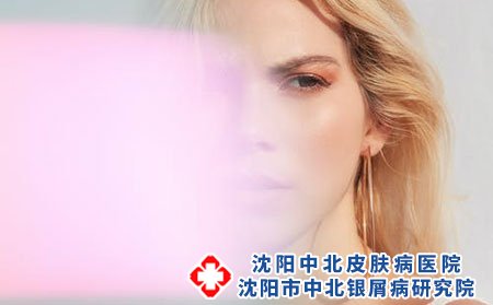 预防脚气要从平常生活中做起