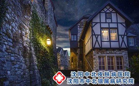 为什么会得足癣?预防足癣复发应该怎么做?