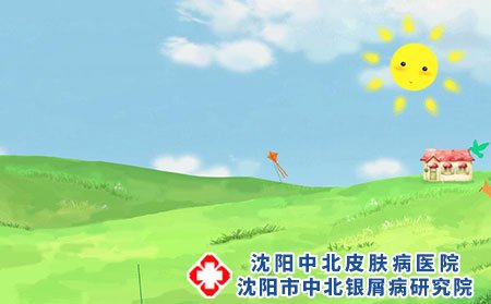 什么是脚气?脚气容易复发怎么办?